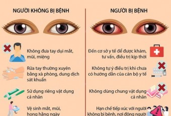 [Video] Khuyên cáo phòng bệnh đau mắt đỏ