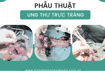 Bác sĩ TTYT Việt Yên giải quyết thành công ca ung thư trực tràng nhờ ứng dụng công nghệ mới cùng tay nghề cao