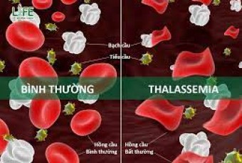 HƯỞNG ƯỚNG NGÀY THALASSEMIA  (BỆNH TAN MÁU BẨM SINH) THẾ GIỚI 08/5/2022